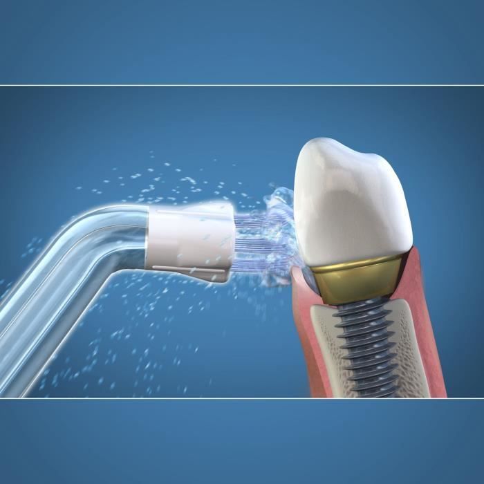 Waterpik Plaque Seeker Oral Irrigator Tip - Plaque Seeker